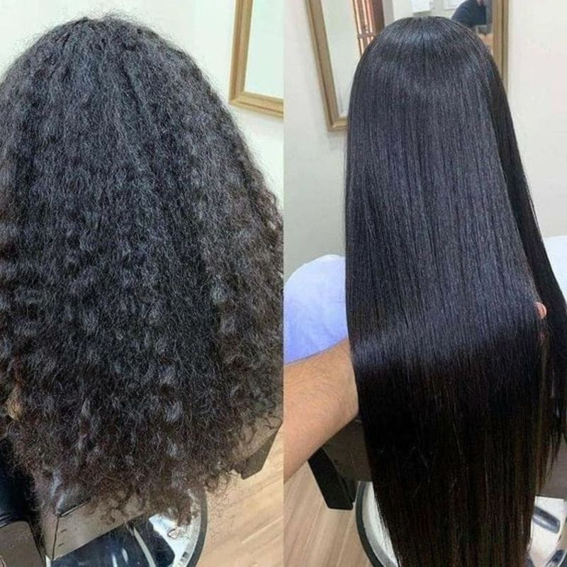 Antes e depois 1